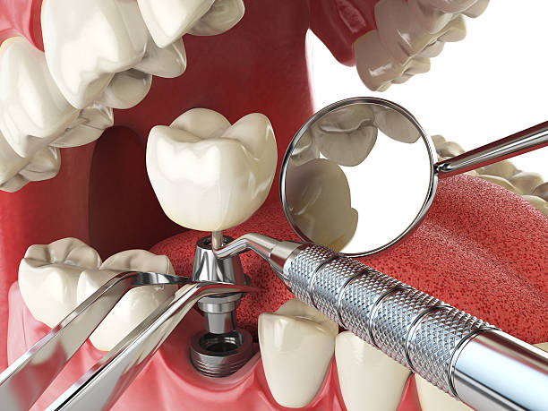 Best Walk-In Emergency Dental Services in Pacific, MO